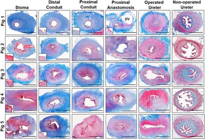 Evaluation of silk fibroin-based urinary conduits in a porcine model of urinary diversion